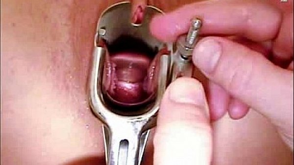 Marie Pussy Exam With Gyno Tools At Clinic thumbnail