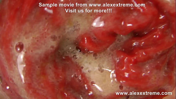 Nonton Firefighter Anal Dildo & Prolapse Hkj thumbnail