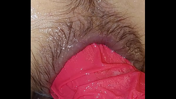 Фистинг анальный thumbnail