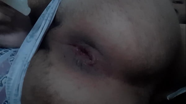 Introduzindo Plug anal 