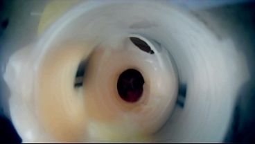 ma bite PULSEà l intérieurvue endoscopique 2 cum_double cum crampie intern camera