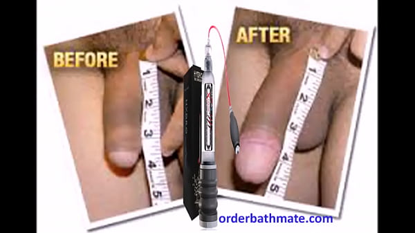 Nonton Enlarge Your Penis With Bathmate Pump-hydromax Pump thumbnail