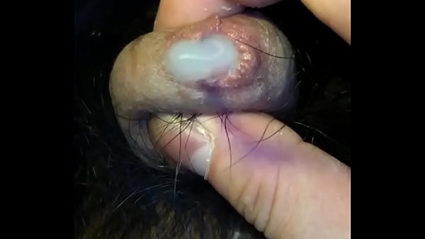 包茎