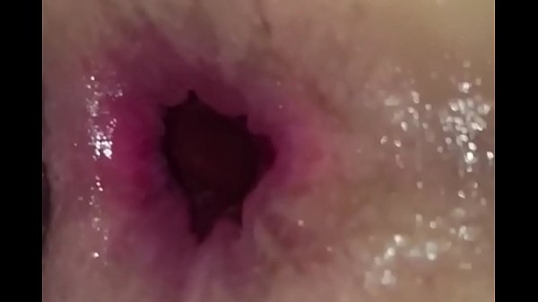 Nonton Je Lui Dilate Le Fion Comme Il Faut. Et Elle Adore &ccedil;a La Cochonne thumbnail