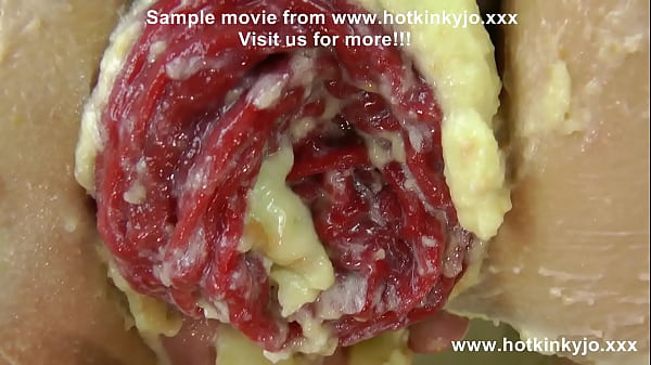 Hkj Anal Cake Fisting thumbnail