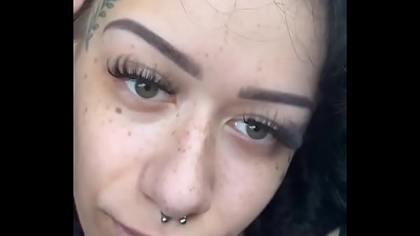 Freckles :)