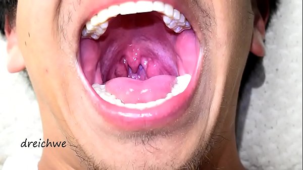 Deep Uvula thumbnail