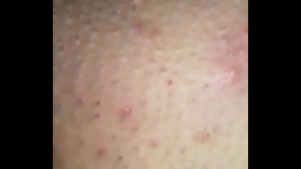 20170110 075952 thumbnail