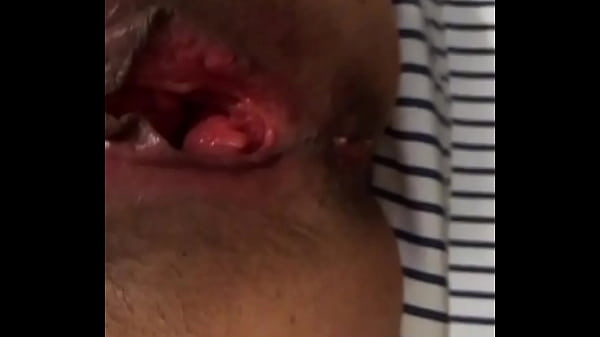 Coroa arrombada