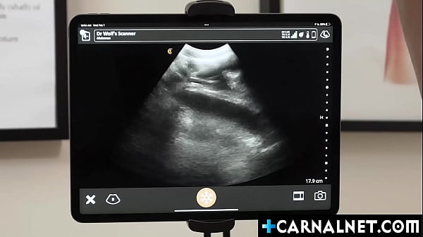 Twink Noah White Getting Another Anal Ultrasound From Doctor Legrand Wolf thumbnail