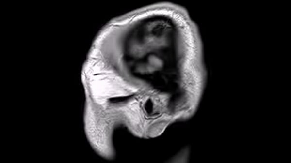 Nonton Structural Mri Animation thumbnail