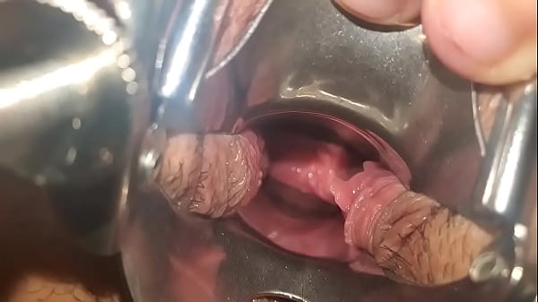 Close Up Gyno Appointment thumbnail