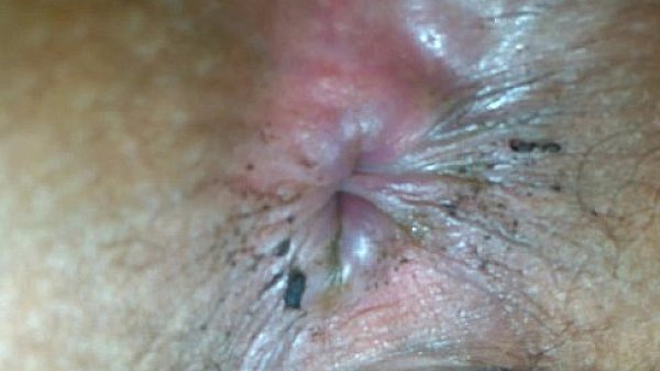 Malaysia Amatuer thumbnail