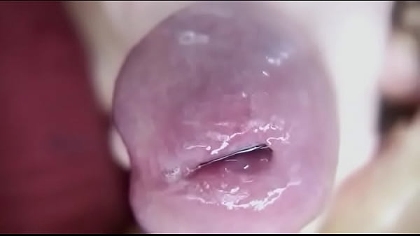 Nut My Feet thumbnail