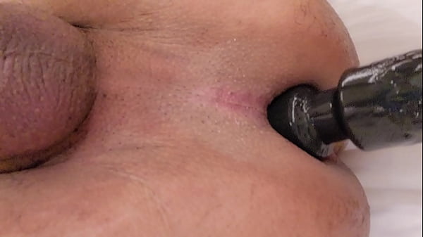 Anal Sex 92 thumbnail