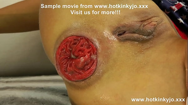 Hkj Anal Destruction Prolapse And Cock In Ass thumbnail